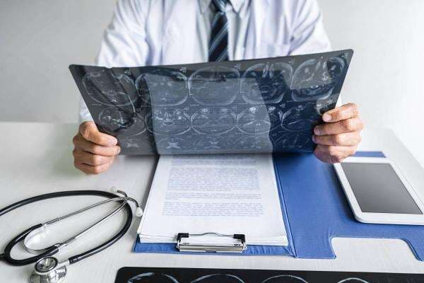 3 Dokter Spesialis Saraf Terbaik di Jakarta yang Bisa Menjadi Pilihan 3 Dokter Spesialis Saraf Terbaik di Jakarta yang Bisa Menjadi Pilihan