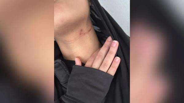 2 Siswi Kembar Muslim Dipukuli Teman Sekalas di AS, Hijabnya Dilucuti dan Diejek 2 Siswi Kembar Muslim Dipukuli Teman Sekalas di AS, Hijabnya Dilucuti dan Diejek