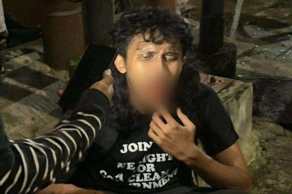 2 Orang Masih Dirawat di RS Brawijaya dan Saiful Anwar usai Unjuk Rasa UU TNI 2 Orang Masih Dirawat di RS Brawijaya dan Saiful Anwar usai Unjuk Rasa UU TNI