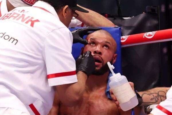 Conor Benn Ungkap Cedera Mengerikan Chris Eubank Jr usai Duel Sengit: Dia Patah Rahang Conor Benn Ungkap Cedera Mengerikan Chris Eubank Jr usai Duel Sengit: Dia Patah Rahang