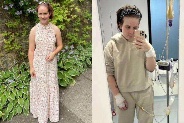 Idap Sindrom Fowler, Wanita 27 Tahun Ini Tidak Bisa Buang Air Kecil selama 6 Tahun Idap Sindrom Fowler, Wanita 27 Tahun Ini Tidak Bisa Buang Air Kecil selama 6 Tahun