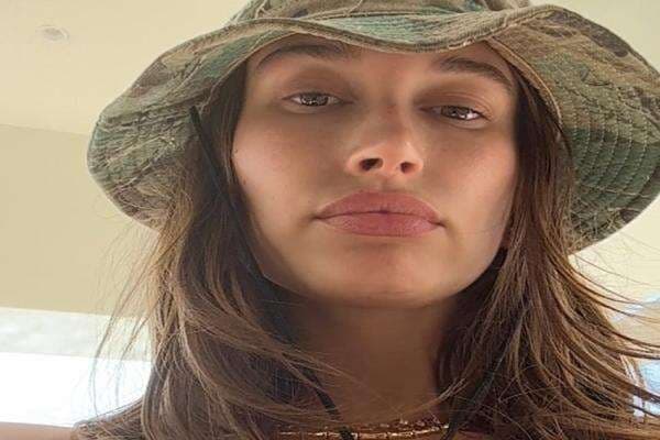 Profil Hailey Baldwin, Istri Justin Bieber yang Ternyata Menderita Kista Ovarium Profil Hailey Baldwin, Istri Justin Bieber yang Ternyata Menderita Kista Ovarium